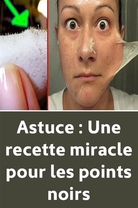 Pas un masque anti point noir mais plusieurs ! Astuce : Une recette miracle pour les points noirs | Point ...