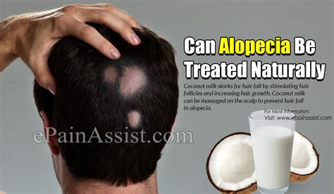 Below are a few types of hair loss you'll find: Can Alopecia Be Treated Naturally