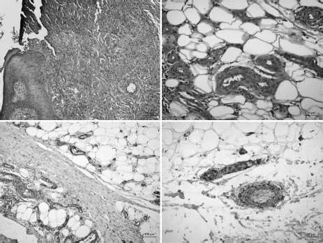 Check spelling or type a new query. Histopatholoic findings Slika 3. Histopatološki nalaz ...