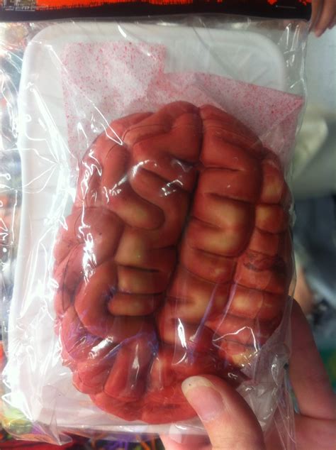 A recent study of 67 dogs diagnosed with primary lung cancer showed that the prognosis depends on several factors such as the cancer histological type, grade, how advanced the cancer is and whether the pets had symptoms at the time of diagnosis the overall median survival of these dogs was 1 year. Live Laugh Lungs: Lung Transplants For Dummies