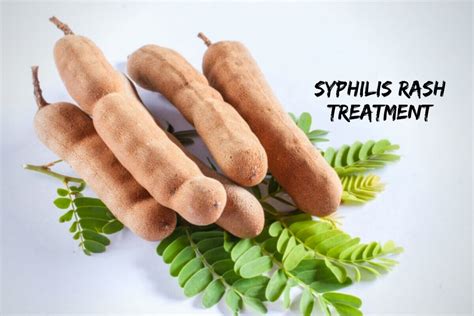 Maybe you would like to learn more about one of these? Syphilis Rash: What Is Syphilis & Its Treatment?