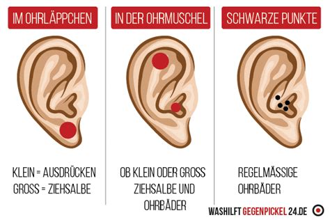Als würden pickel im gesicht, rücken oder schultern nicht reichen, treten die unreinheiten manchmal sogar am ohr auf.die haut ist dort sehr dünn. ᐅ Pickel im Ohr schnell und effektiv loswerden - Ratgeber 2020