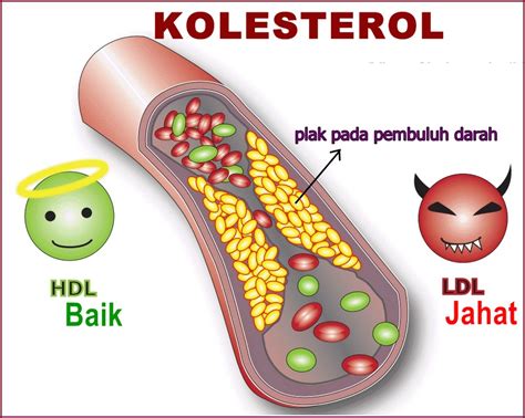 Namun, kelebihan berat badan bisa meningkatkan risiko wanita menderita fibroid rahim. Vitamin Sihat Semulajadi: Khasiat Dan Kebaikan Garlic ...