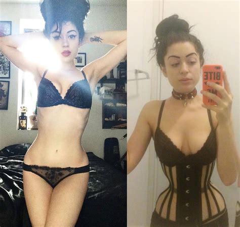 I weighed 128 before taking my first bottle. Bella_malattia_after - Lucy's Corsetry