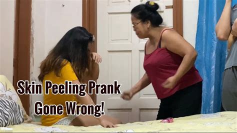 Support healthy melanin pigment in body. Skin Peeling Prank Gone Wrong!!!! - YouTube