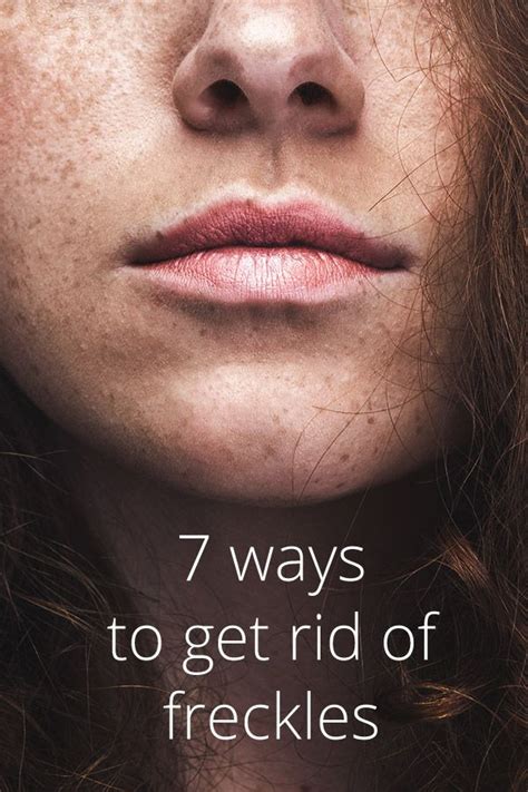 Check spelling or type a new query. How to Get Rid of Freckles: 7 Ways | Freckles, Getting rid ...