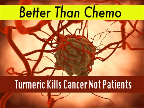 This leo quote can be a bit puzzling at first. Better Than Chemo: Turmeric Kills Cancer Not Patients ...