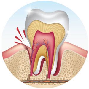 Try sleeping with your head elevated on a thick pillow or several pillows. How To Sleep With A Toothache - Help You Rest Sleep