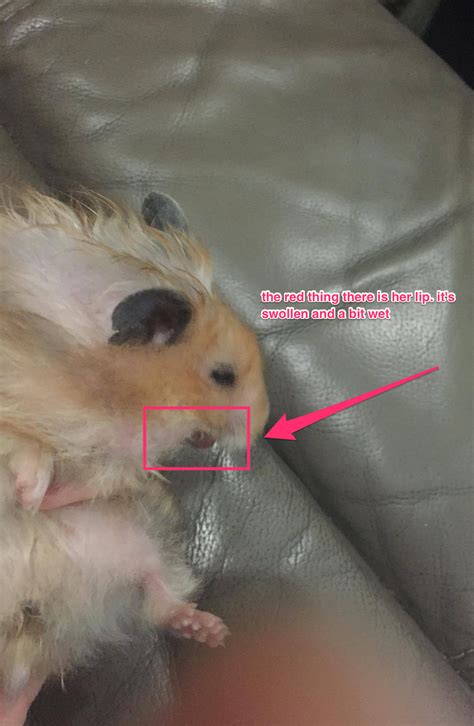Swollen lips that are the result of allergies is a condition known as allergic angiodema. My hamster has this swollen lower lip. I also noticed that