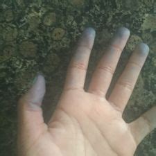 Avoid rubbing the towel into the stain as it could end up embedding the dye further into the carpet fibers. 5 Ways to Get Dye off Skin - wikiHow