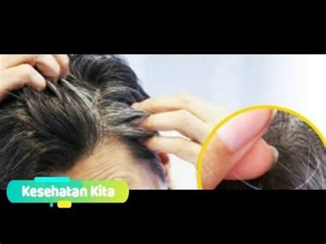 Semir rambut dengan warna hitam. Tidak Perlu Semir, Ini Cara Menghilangkan Uban Secara Alami !! - YouTube | Kesehatan, Obat alami ...