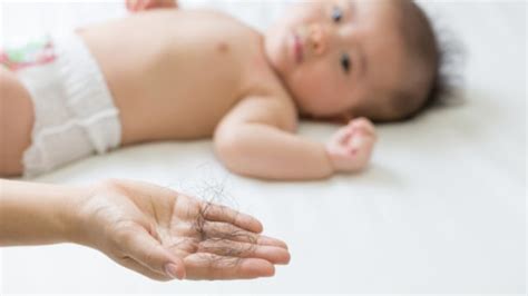 Walaupun rambut gugur adalah perkara biasa, namun ada sebahagian keguguran rambut berpunca daripada masalah tertentu. Kenapa Rambut Bayi Harus Dibotakin? Ini Penjelasan dari ...