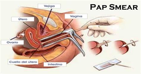 Here are some myths that you likely believe but should stop worrying about. PAPSMEAR sakit la - athirahassin