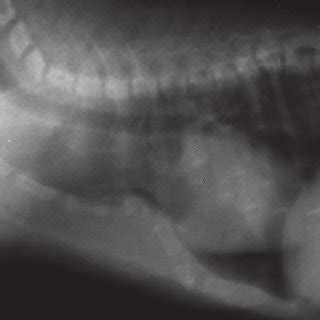 In some people, the depth of the indentation. Data of the two protocols for measuring the chest wall in ...