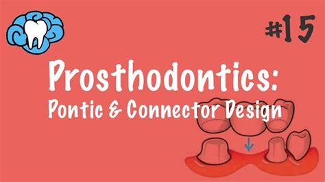 Learn vocabulary, terms and more with flashcards, games and other study tools. PROSTHODONTICS: Pontic & Connector Design - Odonto-Tv