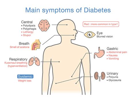 What are the most telling symptoms of Type 2 Diabetes and why you ...