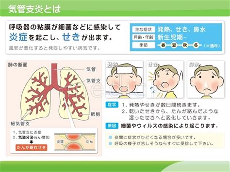 このアカウントには、性的興奮を催すリンクや破廉恥な画像を多数含みます。 もし嫌悪感を感じたらミュートないしはブロック下さい。 #uncensored #無修正 #pornstar #av女優. 気管支炎とはの説明スライド - 医療のイラスト・写真・動画 ...