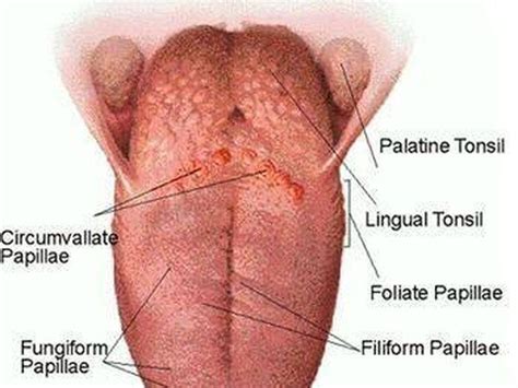 Although metastasis (spread) to other organs. How to Treat Tongue Thrush in 2020 (With images)