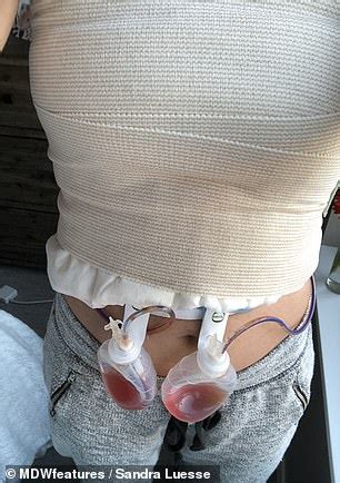 Award-winning actress claims she thought her breast ...