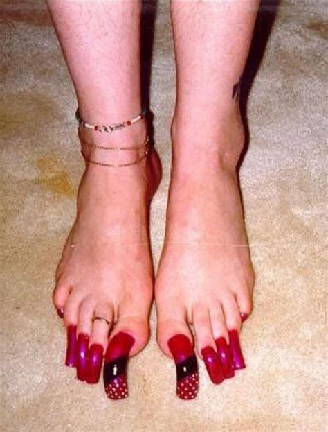 Corta las uñas, incluso las más duras. 12 fotos de las peores uñas de los pies en el mundo. La ...