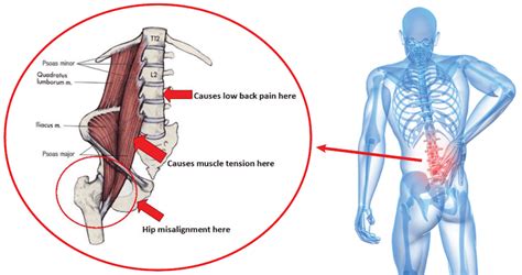 Maybe you would like to learn more about one of these? Pin on Back Problems