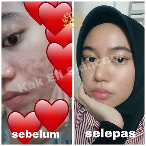 Produk yang sangat efisyen untuk menyimpan perkakasan anda. KAK ELL SKINCARE 3IN1