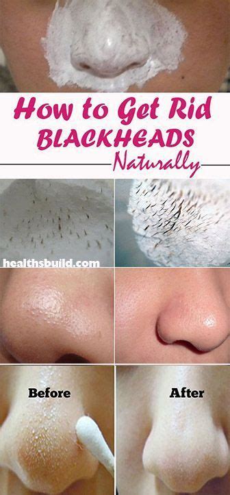 But nasal strips are expensive. Pin on Beauty Board