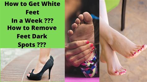Otherwise, a better deal for you is to get a cryotherapy (liquid nitrogen) or laser to remove and. How To Get White Feet In A Week | How To Remove Feet Dark ...