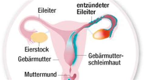 Auslöser für die ausbreitung der pilze ist in erster linie eine geschwächte scheidenflora. Scheide Brennt Und Juckt Innen