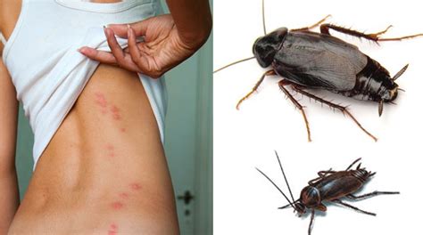 As experienced and licensed pest control professionals, we can tell you exactly what that phrase means in the real world. Cockroach Killer Powder How to Get Rid of German ...