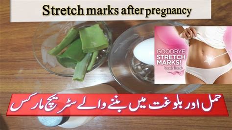 Pregnancy test at home in hindi without kit youtube. How To Remove Stretch Marks After Pregnancy Home Remedy In Hindi - Pregnancy Test Work