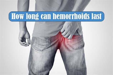 When i first got them, i wasn't even sure what they were. How long can hemorrhoids last - https://howtogetridofhemorrhoidstips.com/how-long-can ...