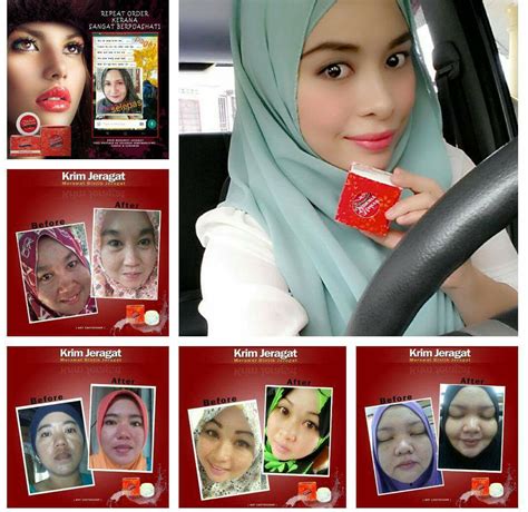 Problem jerawat di kulit muka tentu saja membuat anda menjadi terganggu dan tidak pede. MAHFUZAH_ ESHOP BORONG RETAILS MURAH 013-3045279: MOLEEK ...