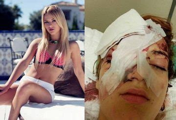 I just cant put the. Bare Naked Islam - 15-year-old Danish teen girl blinded ...