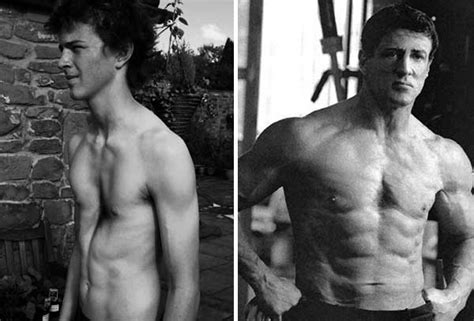 In severe cases, pectus excavatum can look as if the center of the chest has been scooped out, leaving a deep dent. What Is Pectus Excavatum - How To Fix It In 2019 & More