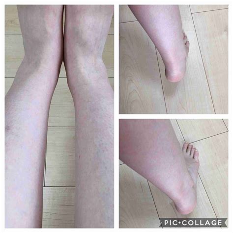 足首だけ太い人 | ガールズちゃんねる - Girls Channel