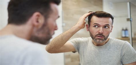 El pelo se cae habitualmente debido a los ciclos de vida de nuestros folículos capilares. ¿Se me cae mucho el pelo? - Inpylus