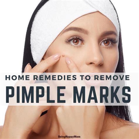 If you have more pimple marks, then you should use it regularly. 13 Home Remedies To Remove Pimple Marks Naturally for Oily ...