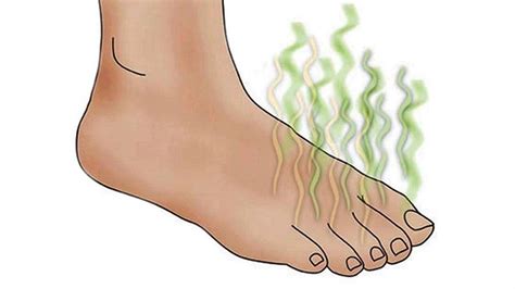 Here's a complete guide on how to get rid of smelly feet. Smelly Feet: Causes, Prevention, & How To Get Rid Of ...