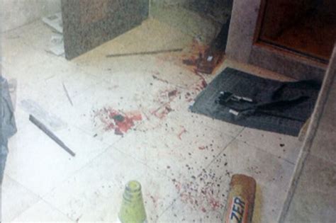 I have come to believe that we should see these photos. Kolwin Vincent's blog: Shocking PHOTOS Emerge Of Oscar ...