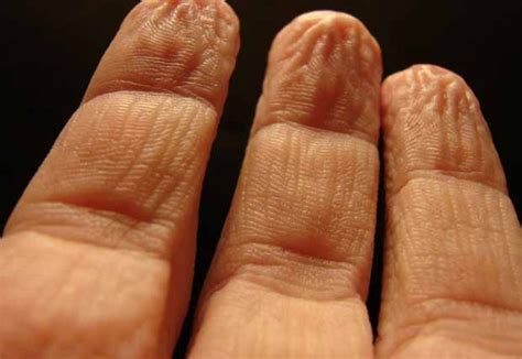 Wrinkled fingers when wet make 'objects easier to grasp' | Metro News
