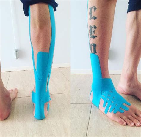 We did not find results for: Kinesio tape shin splints instructions