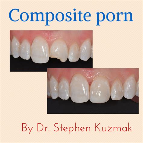 It's easy, just requiring a few photoshop selection skills, the use of layers and a few other easily learning. Composite porn with Dr. Art Volker, Dr. Steve Kuzmak and Dr. Matt Costa (DHP60)