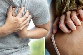 Perspiring a ton It very well may be a coronary failure say specialists