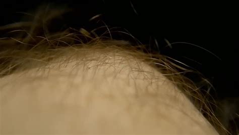 Pubic hair for ngv8 is a transplant edition of pubic hair for ngv7. Pubic Lice Crawling Through Hair Stock Footage Video (100% Royalty-free) 15542248 | Shutterstock