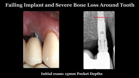 Other carecredit providers near you. Smile Gallery - Before and After Dental Photos - Smile ...