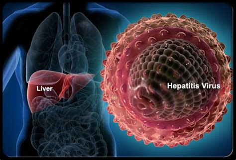 A randomized, controlled trial of combination therapy for chronic hepatitis b: Celiac Disease Hepatitis B Vaccine Failure - Celiac ...