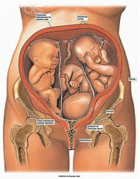 26.11.2018 · decuplet (plural decuplets) one of a group of ten babies born at the same birth. Pretty close to accurate, except my Baby B was head down ...