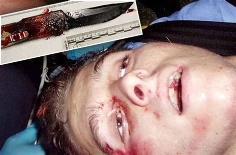 Grant amato day 2 witness: Face-Eating Florida Man: Horrific Crime Scene Photos ...