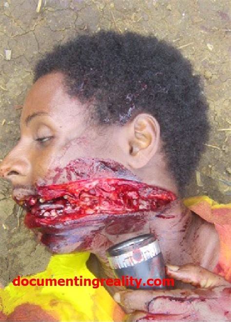 Documenting reality death pictures & death videos: Shot and Slashed in the Neck/mouth Area